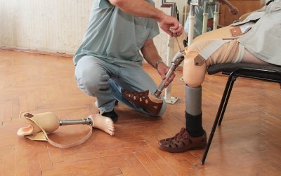 Traumatic Amputation Compensation Attorney in Atlanta, GA