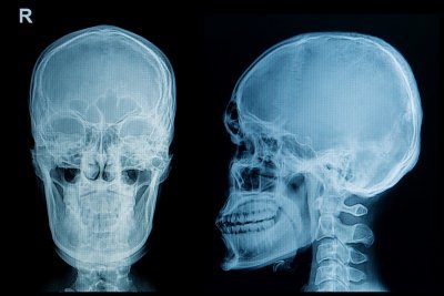 Head Injury Lawyers in Atlanta, GA